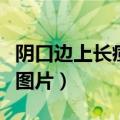 阴口边上长痘痘什么原因（女性毛囊炎的症状图片）