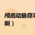 颅底动脉痉挛是什么意思啊（痉挛是什么意思啊）