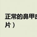 正常的鼻甲应该是什么颜色（正常鼻甲清晰图片）