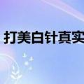 打美白针真实经历视频（打美白针真实经历）