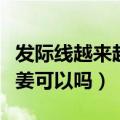 发际线越来越高怎么办用生姜（发际线高用生姜可以吗）
