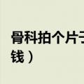 骨科拍个片子大概要多少钱（去医院拍片多少钱）