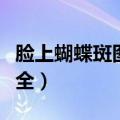 脸上蝴蝶斑图片大全高清（脸上蝴蝶斑图片大全）