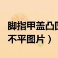 脚指甲盖凸凹不平是怎么回事（脚指甲盖凹凸不平图片）