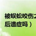 被蜈蚣咬伤之后会不会怎么办（被蜈蚣咬了有后遗症吗）
