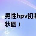 男性hpv初期小红点照片（艾滋病初期皮疹症状图）