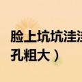 脸上坑坑洼洼毛孔粗大图片（脸上坑坑洼洼毛孔粗大）