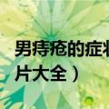 男痔疮的症状图片大全视频（男痔疮的症状图片大全）
