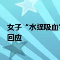 女子“水蛭吸血”治病后休克抢救，疑全身细菌感染，多方回应
