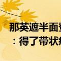 那英遮半面登上“歌手2024”舞台 原因公布：得了带状疱疹