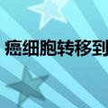 癌细胞转移到脑部还能活多久（癌细胞转移）
