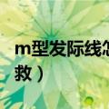 m型发际线怎么补救女生（m型发际线怎么补救）