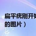 扁平疣刚开始长的图片脖子（扁平疣刚开始长的图片）