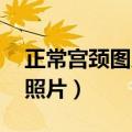 正常宫颈图片高清 下垂（正常宫颈图片真实照片）