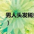 男人头发稀好不好（男人头发稀疏的8个原因）