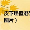 皮下埋植避孕有效期多久（皮下埋植避孕伤口图片）