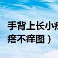 手背上长小疙瘩不痒图片大全（手背上长小疙瘩不痒图）