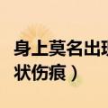 身上莫名出现线状伤痕图片（身上莫名出现线状伤痕）