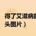 得了艾滋病的舌头是怎么样的（得了艾滋病舌头图片）
