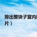 排出整块子宫内膜图片为什么肚子疼（排出整块子宫内膜图片）